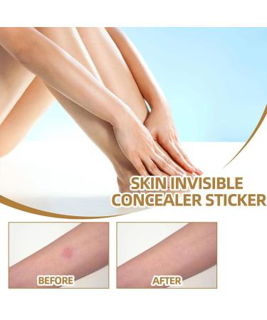 5 Breathable Skin Invisible Up Stickers Skin Scar Pimple Sticker | Waterproof Skin Tone Invisible Sticker Skin Concealing Patches 60 5 Pcs 60patch/Box - Buy Online on GoSupps.com