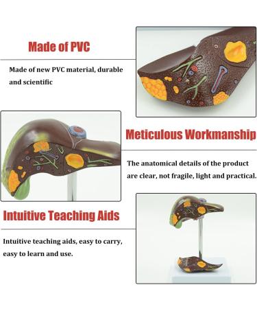 Liver Pathology Model Fatty Cirrhosis Carcinoma Demonstration Model Shows 7 Liver Diseases Detachable 2 Parts for Doctors Office Educational Tool - Buy Online on GoSupps.com