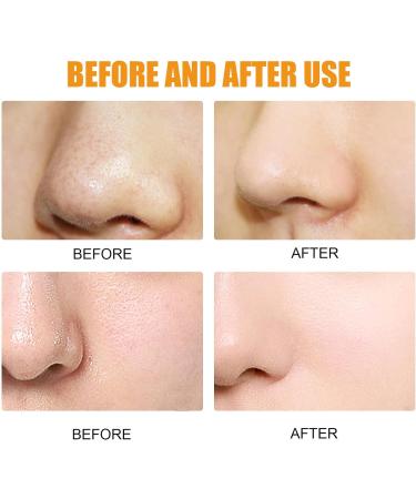 Pore Cleansing Strips - 10pcs Hydrocolloid Blackhead Remover Patches for Oily Skin - Buy Online on GoSupps.com