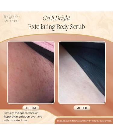 Forgotten Skincare Get It Bright Exfoliating Body Scrub with Glycolic Acid & Pumice for Dark Armpits Bikini Area KP Bumps Rough Skin Daily AHA Polish to Smooth Soften & Prep Sensitive Areas - Buy Online on GoSupps.com
