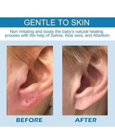Effective Piercing Cleaner | Aftercare for Abdominal & Nose Piercings - Safe for Scars Nodules & Cartilage - Buy Online on GoSupps.com