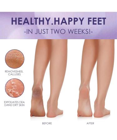 Exfoliating Foot Mask - 2 Pairs of Lavender & Roses Cornea Socks for Effective Foot Care | Unisex Dead Skin Remover - Buy Online on GoSupps.com