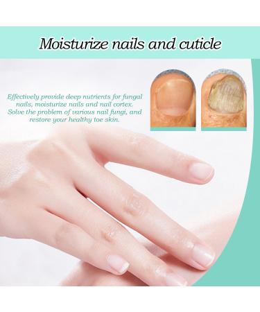 4-Piece Nail Care Pen Set - Nail Repair Treatment with Tea Tree Oil Vitamin E & Aloe Vera for Healthy Fingernails & Toenails - Buy Online on GoSupps.com