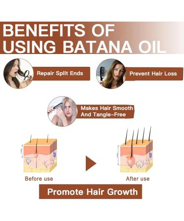 PCC PTYXIS Batana Oil Oil for dry and damaged hair deep moisture against hair loss and repair of damage removes split ends suitable for men and women 1 120 g Paquete de 1 - Buy Online on GoSupps.com