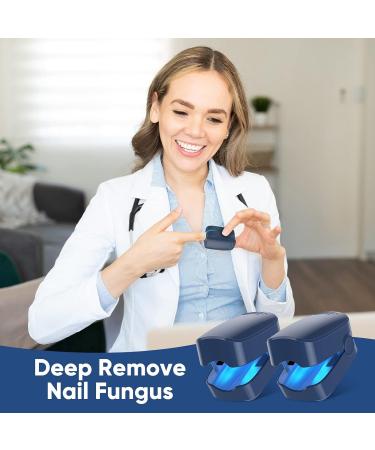 Nail Fungus Laser Treatment Device - 2 Pack for Onychomycosis | Effective Therapy for Discolored, Brittle Nails | Home Use for Fingernails & Toenails - Blue - Buy Online on GoSupps.com