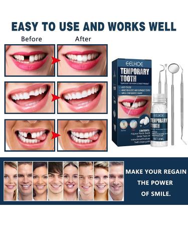 Ganbaro Temporary Teeth Repair Kit - Moldable False Teeth for Instant Smile | Includes Mouth Mirror & Dental Probe | 3 Pcs Set - Buy Online on GoSupps.com