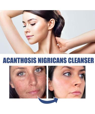 Acne & Spots Cleansing Lotion Relief 50ml | Facial Cleanser for Dry Skin - Reduce Dullness - Buy Online on GoSupps.com