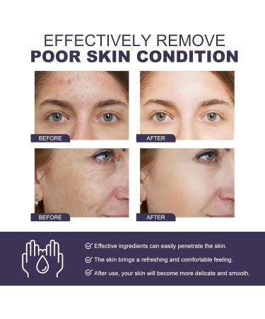 Mikabila (04)30ml*2 Vitamin B3 Niacinamide Face Serum Niacinamide Facial Serum with Vitamin B3 Anti-Wrinkle Anti-Ageing Serum Dark Spots Corrector Reduce Fine Lines Wrinkles Anti Pigment Spot Serum - Buy Online on GoSupps.com