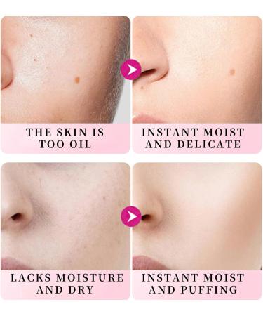 Intensely Hydrating Moisturizer for Face Face Moisturiser Cream for Acne-prone Sensitive Oily Dry Skin Hyaluronic Acid Moisturiser for skin Care with Blue Light Protection Repairing Reduce Redness - Buy Online on GoSupps.com