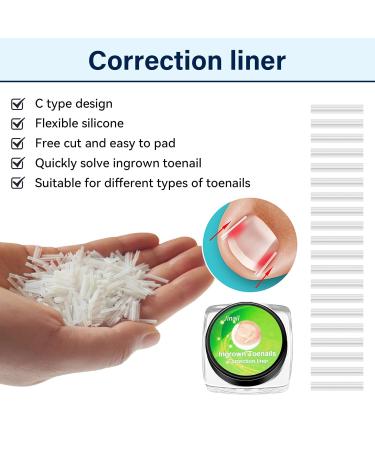 152-Piece Ingrown Toenail Tool Set & Correction Patch for Ingrown Toenails - International Shipping Available - Buy Online on GoSupps.com