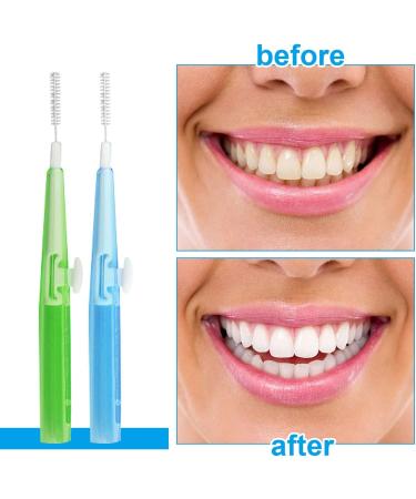 Skhaovs 70-Piece Interdental Brush Set - 0.7mm & 0.8mm Push-Pull Dental Floss Picks for Effective Oral Care | International Shipping Available - Buy Online on GoSupps.com