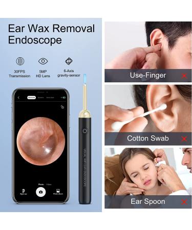 Wireless HD 1080P Ear Wax Removal Camera with 3.5mm Otoscope, 6 LED Lights - Waterproof Ear Scope for iPhone, iPad & Android - Kids, Adults, Pets - Black - Buy Online on GoSupps.com