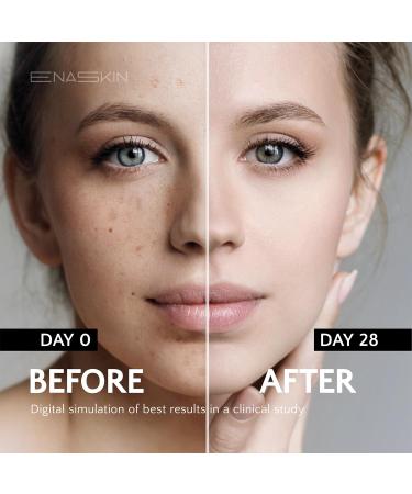 EnaSkin Dark Spot Remover for Face and Body: Advanced Formula Spot Corrector Cream to Fade Age Spots Sun Spots Freckles Melasma and Brown Spots for Women and Men (1.7 Oz) 1.7 Fl Oz (Pack of 1) - Buy Online on GoSupps.com