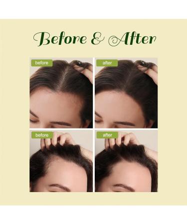 Veganic Hair Growth Oil - Natural Hair Oil for Men & Women | 2pcs | Boost Hair Growth Globally - Buy Online on GoSupps.com