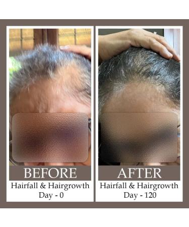 ESSENTIALS Hair Serum - For all hair types - Protects against hair loss - Buy Online on GoSupps.com