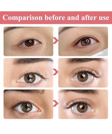 Wusanna Eye Cream & Eyelid Styling - Double Eyelid Shaping Cream & Invisible Stripes for Natural Look (3 Pieces + 3 Y-Tines) - Ideal for International Shipping - Buy Online on GoSupps.com