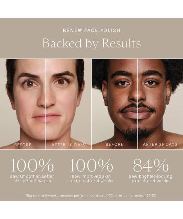 Oak Essentials Renew Face Polish | Gentle Exfoliating Face Scrub with Pineapple Extract Vitamin C & Polishing Beads 3.4 Oz 3.4 Fl Oz (Pack of 1) Multicolor - Buy Online on GoSupps.com