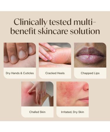 Aveeno Skin Relief Healing Ointment 72-Hour Skin Protectant with Triple Oat & Shea Butter for Extra Dry Cracked & Sensitive Skin Fragrance-Free & Multi-Use for Lips 7.2 oz - Buy Online on GoSupps.com