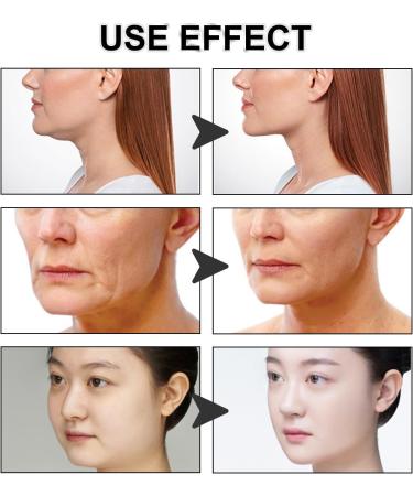 KOAHDE Face Lifting Invisible Patch Updated Face Lift Tape Tightening Skin Invisible Stickers Facial Lift Strips Facial Lifting Patch Instant Face Lifting Strips for Double Chin Face Lift Stickers - Buy Online on GoSupps.com