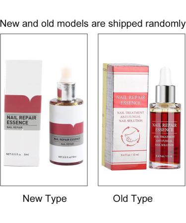 Nail Repair Essence 15ML Nail Fungus Treatment Natural Nail Care Toe Nail Fungus Treatment for Damaged Discolored Nails Antifungus Nail Treatment - Buy Online on GoSupps.com