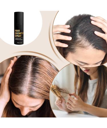 Tanxemery Hair growth spray 50 ml hair growth accelerates hair growth accelerates hair growth serum prevents hair loss hair oil growth beard growth soft dry - Buy Online on GoSupps.com