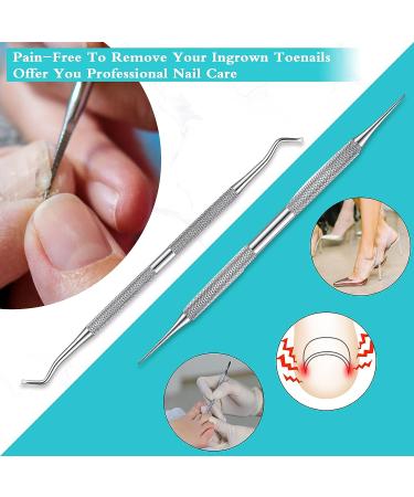 Lanties 152 Pieces Ingrown Toenail Corrector Treatment Set - Includes Curved Brace, Corrector Sticker, Strips, File, and Lifter - Buy Online on GoSupps.com