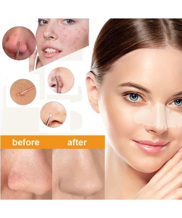Blackhead Remover Kit - 16pcs Set with Portable Box - Buy Online on GoSupps.com