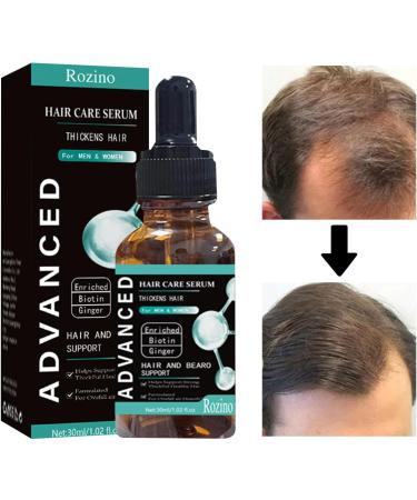 higyee Liquid Biotin Organic Hair Growth Essence Powerful Vitamin B Supplement Strong Nails and Healthy Skin Extra Strength Gel Drops 1 OZ for Women and Men - Buy Online on GoSupps.com