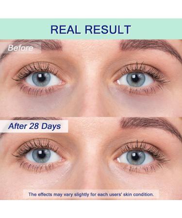 Eye Cream for Dark Circles & Puffiness - Anti-Aging Caffeine Serum with 360 Cooling Applicator | 0.5 Fl Oz | Perfect Stocking Stuffers for Women - Buy Online on GoSupps.com