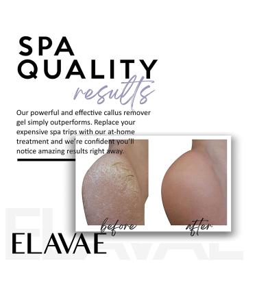 ELAVAE Foot Callus Remover Gel - Dead Skin Remover for Feet - Works with Pumice Stone or Scraper - Scent Free - 4 Fl Oz - Buy Online on GoSupps.com