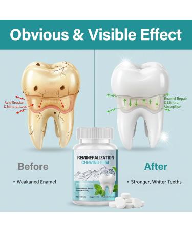 Remineralizing Gum with Hydroxyapatite Hydroxyapatite Gum for Teeth 120 Count Sugar Free Enamel Strengthening & Remineralization Tablets for Enamel Repair & Fresh Breath Non-GMO - Buy Online on GoSupps.com