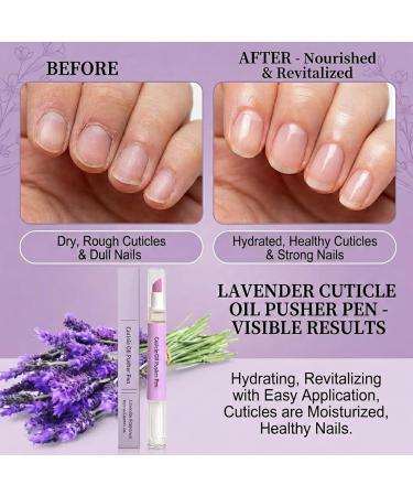 Lot de 8 repousse-cuticules avec pointe en c ramique - Stylo de soin des ongles 3 en 1 - Stylo d'huile pour cuticules avec applicateur lisse - Crayons huile tampon pour Hangnail 8 pi ces. - Buy Online on GoSupps.com