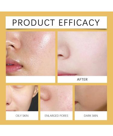 Exfoliating Rice Ampoule Rice Serum for Gentle Face Peel Dead Skin Remover Pore Minimizing & Deep Hydration Exfoliant with Hyaluronic Acid for Glowing Skin All Skin Types (White Rice 30ml) White Rice 1 Fl Oz (Pack of 1) - Buy Online on GoSupps.com