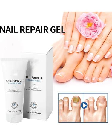  REPWEY 2023 New Healio Nail Treatment Gel Nail Strengthener Nail Growth Treatment for Brittle Peeling Breaking Thin Nails (2 Pieces) - Buy Online on GoSupps.com