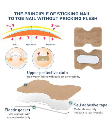 Fitmedify Ingrown Toenail Corrector Kit - Nail Patches for Ingrown Toenail Treatment and Removal - Buy Online on GoSupps.com