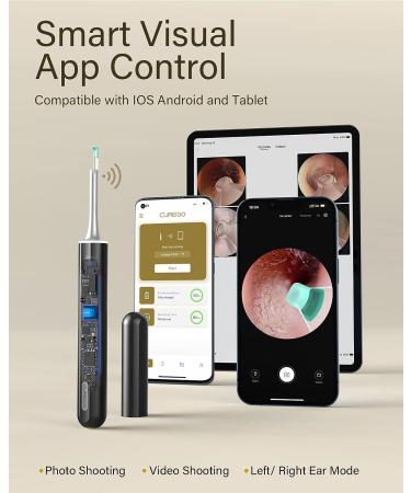 Ear Cleaner Earwax Removal Kit with 1080p Otoscope - Ear Wax Remover Camera for iPhone & Android - Buy Online on GoSupps.com