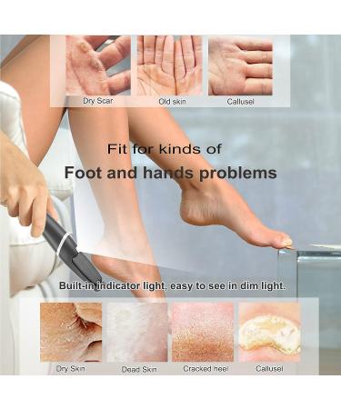 Electric Callus Remover for Feet - 17 in 1 Rechargeable Pedicure Tool Set with Waterproof Foot Scrubber - Dead Skin Remover with 4 Roller Heads - Professional Foot File for Smooth Feet - 2 Speed Black - Buy Online on GoSupps.com