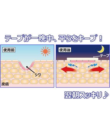 Facial Wrinkle Flattening Patches for Forehead & Smile Lines Laugh Lines Night Wrinkle Care Transparent 24 Pieces (12pc for forehead 12pc for smile line) - Buy Online on GoSupps.com