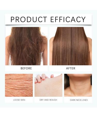 Organic Prickly Pear Seed Oil New Organic Prickly Pear Seed Oil 100% Natural Cold Pressed+ Pipette Organic Prickly Pear Oil Face Anti-Aging and Anti Dark Circles Organic (1) - Buy Online on GoSupps.com