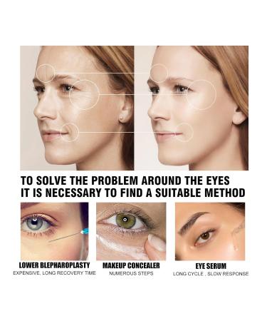 Buy Celyn Instant Eye Tighter & Eye Bag Cream - Anti-Aging Eye Cream for All Skin Reduces Eye Bags & Fine Lines (1 Pack) - Fast International Shipping - Buy Online on GoSupps.com