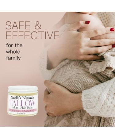 Organic Tallow Balm - 2oz Jar - Lavender Chamomile - All-In-One Skin Balm - Soothing Healing Moisturizing for all Skin Types - Excellent for Dry Skin Eczema Burns Cuts Boo-Boos Cracked Heels - Buy Online on GoSupps.com