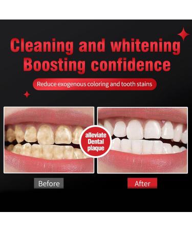  Boxiatil SP-10 Pack of 2 Probiotic Toothpastes Natural Whitening Fresh Breath Toothpaste Strengthens Tooth Enamel Fluoride-Free Gentle on Sensitive Teeth Daily Dental Care #01 - Buy Online on GoSupps.com