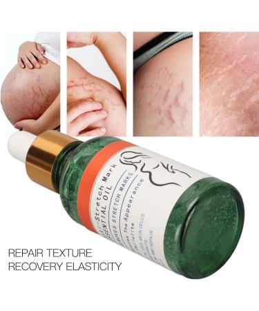 Scar Prevention & Stretch Mark Repair Essential Oil - Premium Beauty Solution for Women | Shop Now! - Buy Online on GoSupps.com