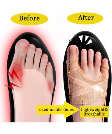 Hallux Valgus Correction - Pain Relief Bandage for Bunions | Slipproof Hallux Valgus Rail (1 Pair) - Buy Online on GoSupps.com