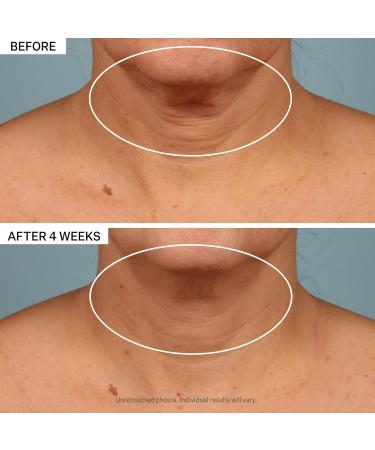 StriVectin Super C Retinol Vitamin C Serum & TL Neck Cream - Brighten & Correct 2 Piece Kit | International Shipping - Buy Online on GoSupps.com