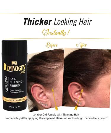 Revivogen MD Keratin Hair Building Fibers - Dark Brown Hair Fibers for Thinning Hair Hairline Powder & Fiber Spray for Men and Women (0.9oz - Buy Online on GoSupps.com