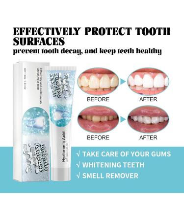 Whitening Toothpaste Removing Stains Whitening Toothpaste Clean Mouth Cool And Refreshing Fully Foam Brightening White Prevents Stains Protects Gums Fresh Breath Complete Care Teeth (3) - Buy Online on GoSupps.com