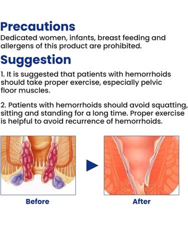 EKYOSHCZ Natural Herbal Hemorrhoid Capsules - Rapid Pain Relief (2 Pcs) - Buy Online on GoSupps.com