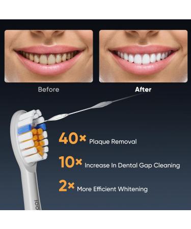 Soocas Neos Electric Toothbrush & Mouth Shower - 2-in-1 Portable Wireless Tooth Cleaning Kit 40x Plaque Removal Travel & Home Use White - Buy Online on GoSupps.com