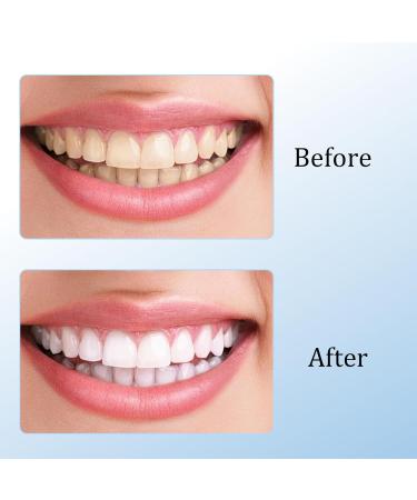 Whitening Toothpaste Niacinamide Whitening Toothpaste Dazzling White Nicotinamide Toothpaste Nicotinamide Teeth Whitening Fresh Breath Complete Teeth Care - Buy Online on GoSupps.com